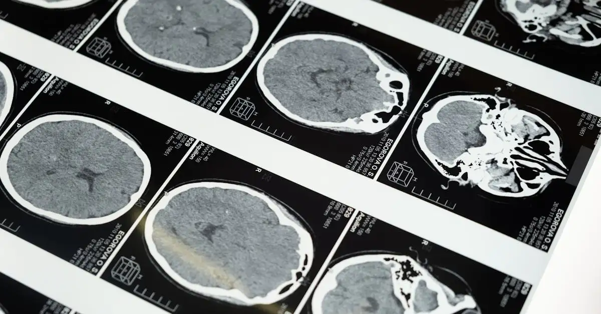 Beginnende nierstenen: symptomen, oorzaken en behandeling