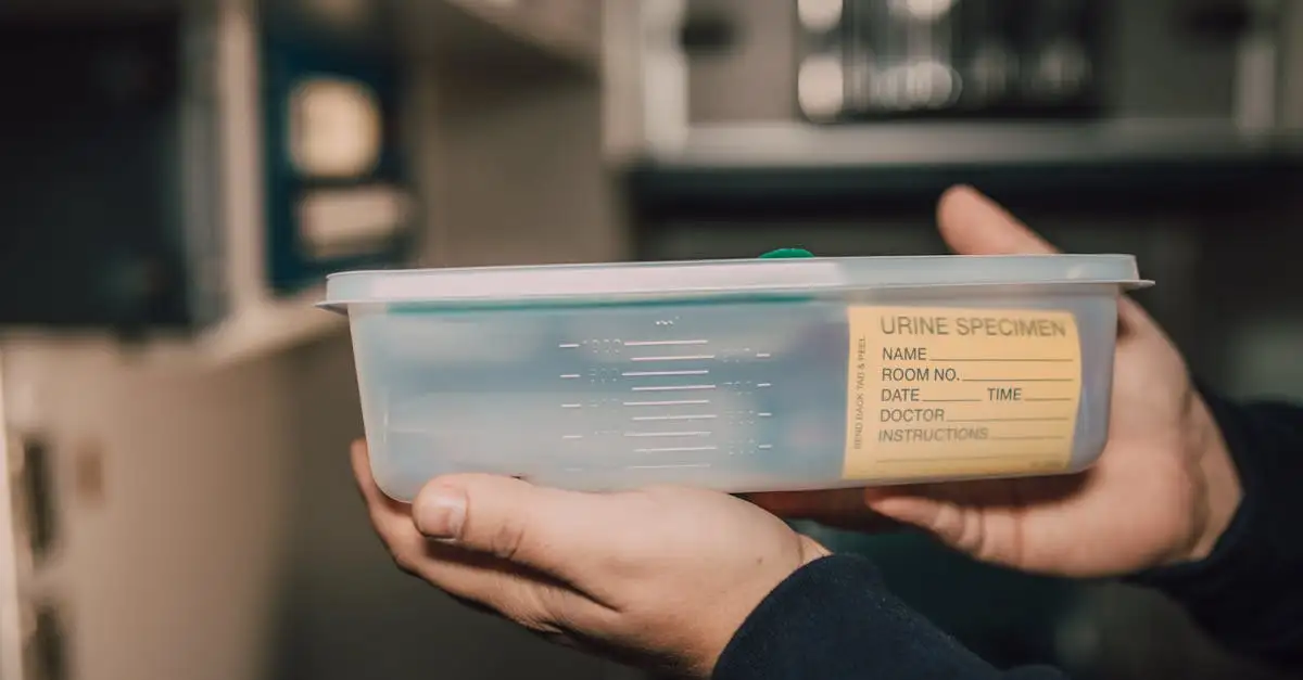 Nierstenen in urine: oorzaken, symptomen en behandeling
